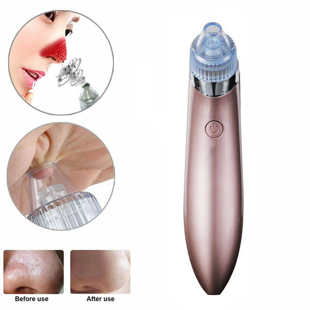 Electric Blackhead Vacuum Pore Cleaner 2.0