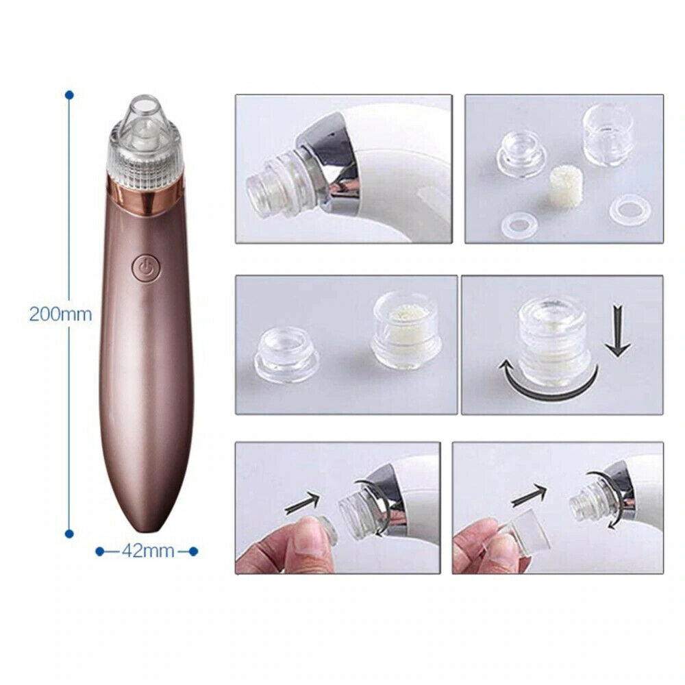 Electric Blackhead Vacuum Pore Cleaner 2.0