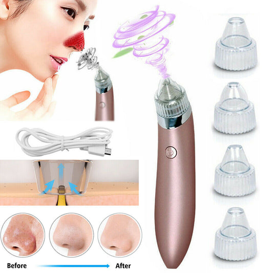 Electric Blackhead Vacuum Pore Cleaner 2.0